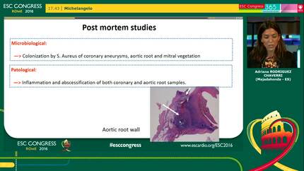Not everything is what it seems: mycotic aneurysms and mitral endocarditis in the setting of churg strauss syndrome.