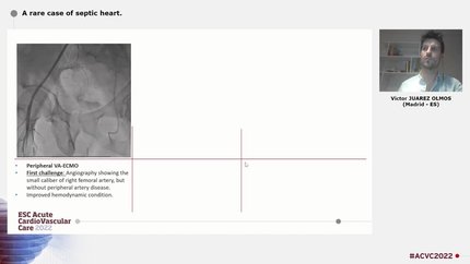 Presentation thumbnail