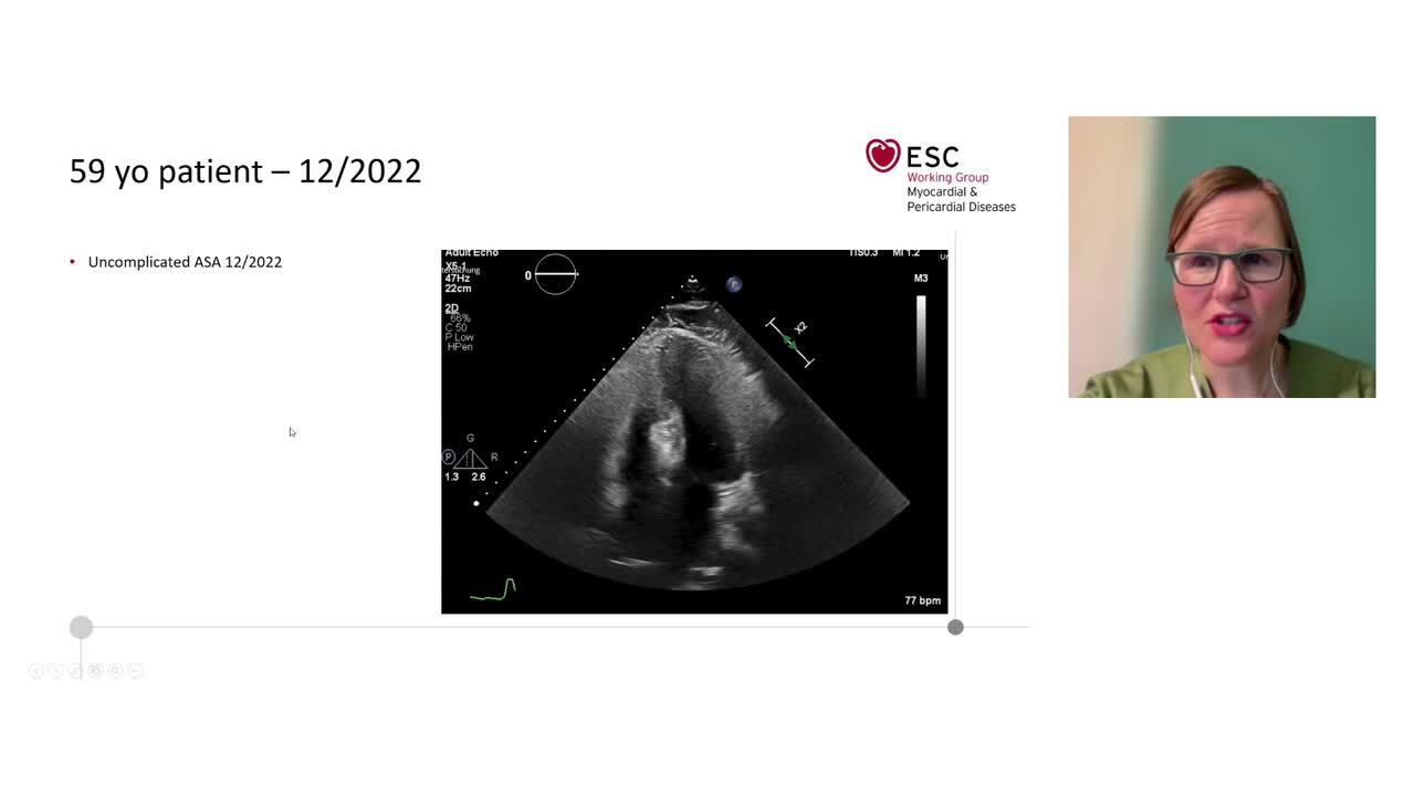 Hypertrophic cardiomyopathy: perspectives of the specialist and non-specialist in a healthcare environment