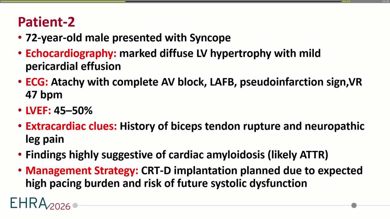 Sheath-free implantation of an 8.6 Fr stylet-driven ICD lead at the high septum: toward a physiologic ICD