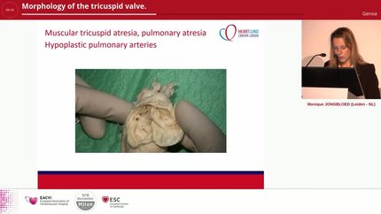 Presentation thumbnail