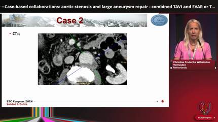 Case-based cardiovascular collaborations: working together for a better future?