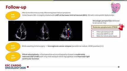 Beyond ejection fraction: managing HER2 positive breast cancer in a patient with severe mitral regurgitation and prior anthracyclines