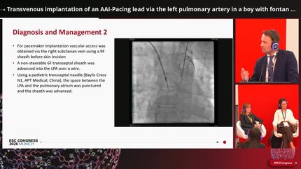 Transvenous implantation of an AAI-Pacing lead via the left pulmonary artery in a boy with fontan palliation