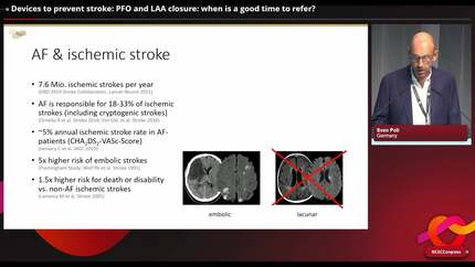 Cardiology consult in the stroke patient: state of the art
