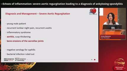 Echoes of inflammation: severe aortic regurgitation leading to a diagnosis of ankylosing spondylitis