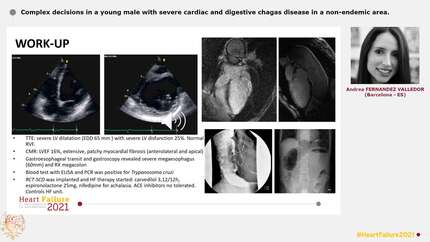 Complex decisions in a young male with severe cardiac and digestive chagas disease in a non-endemic area.