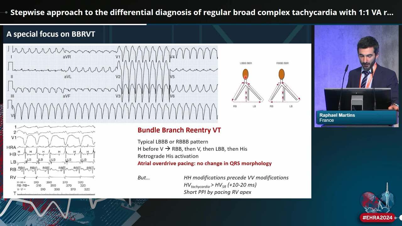 Stepwise approach to the differential diagnosis of regular broad complex tachycardia with 1:1 VA relationship in the EP lab: let’s use it all!