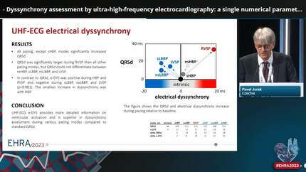 Dyssynchrony assessment by ultra-high-frequency electrocardiography: a single numerical parameter to identify the relationship between right and left ventricular depolarization