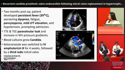 Recurrent candida prosthetic valve endocarditis following mitral valve replacement in hypertrophic obstructive cardiomyopathy