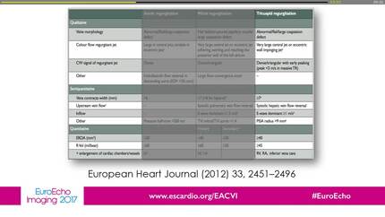 Quantification and pathpphysiology of tricuspid regurgitation.