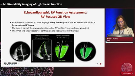 Presentation thumbnail