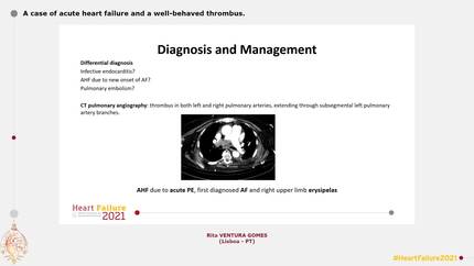 A case of acute heart failure and a well-behaved thrombus.