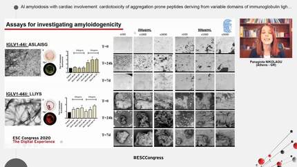 Al amyloidosis with cardiac involvement: cardiotoxicity of aggregation prone peptides deriving from variable domains of immunoglobulin light chains