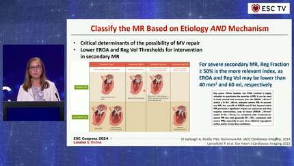 Echocardiography Made Easy: heart valve disease