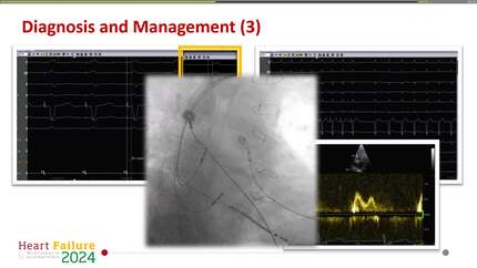 Presentation thumbnail