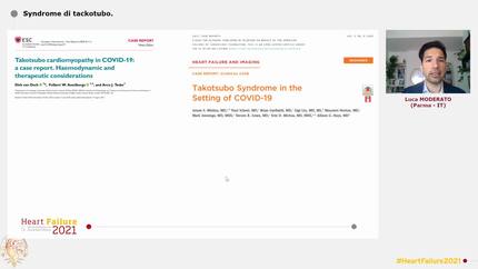 Syndrome di tackotubo.