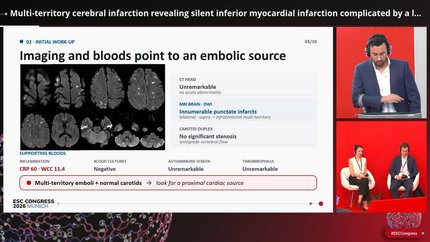 Multimodality imaging in acute coronary syndromes
