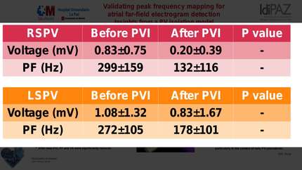 Validating peak frequency mapping for atrial far-field electrogram detection: insights from a pulmonary vein isolation model