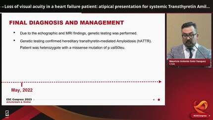 Loss of visual acuity in a heart failure patient: atipical presentation for systemic Transthyretin Amiloid Disease 