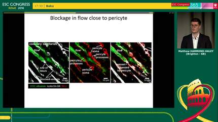 Capillary pericytes contribute to coronary no-reflow following myocardial infarction and reperfusion