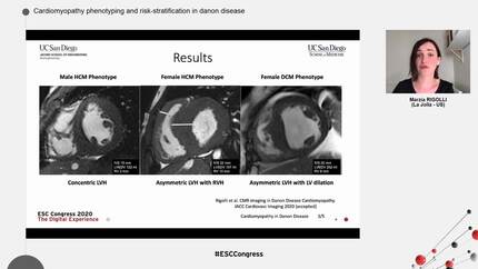 Cardiomyopathy phenotyping and risk-stratification in danon disease