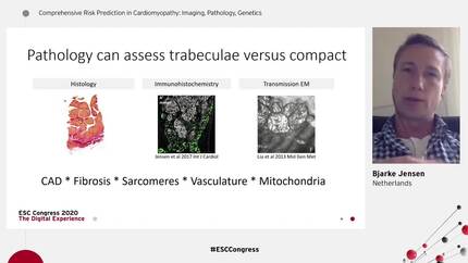 Case 2 - Comprehensive risk prediction in the dilated heart.