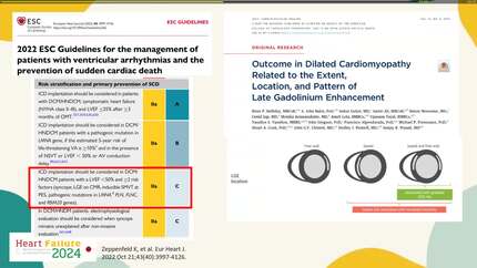ICD implantation in primary prevention. Beyond left ventricular ejection fraction.