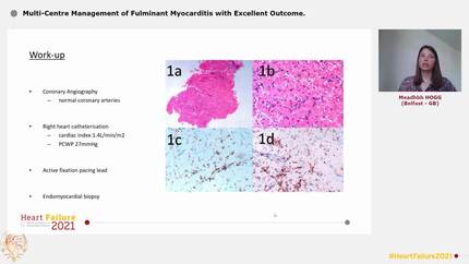 Multi-Centre Management of Fulminant Myocarditis with Excellent Outcome.