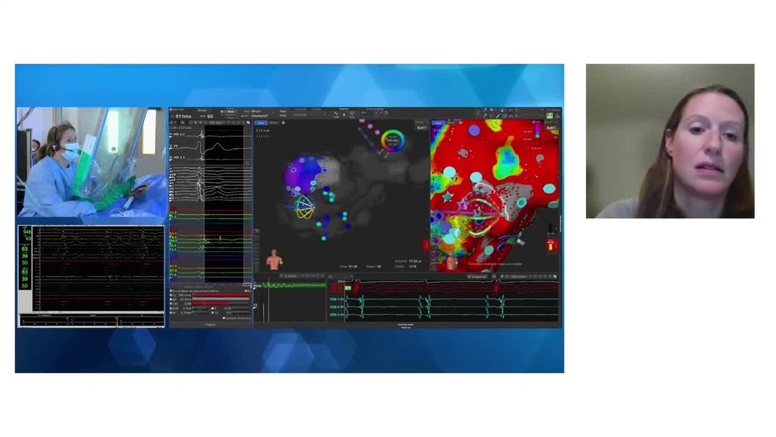 ESC 365 - Shining through - new frontiers for temperature-controlled RF ...