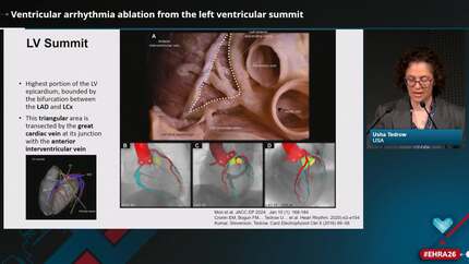 Ablation of ventricular arrhythmias in challenging scenarios