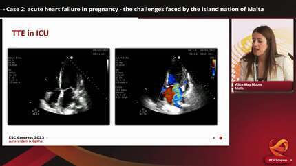 Presentation thumbnail