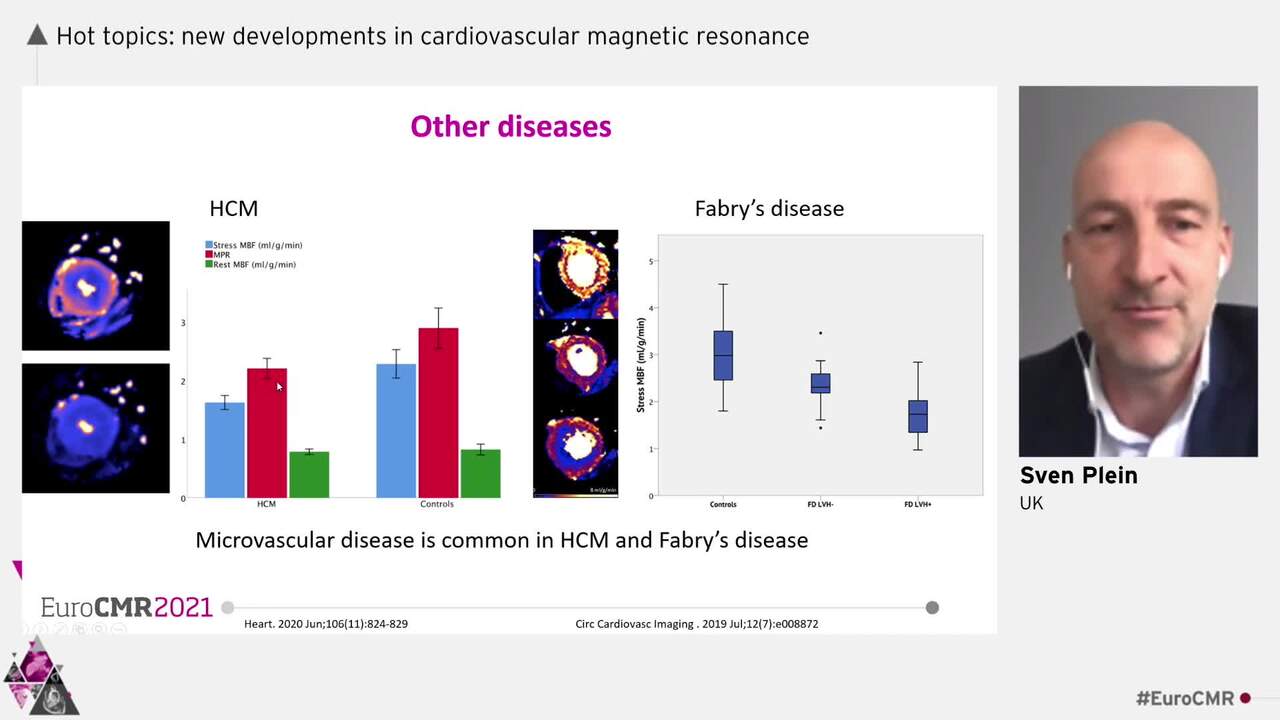 Myocardial perfusion quantification.