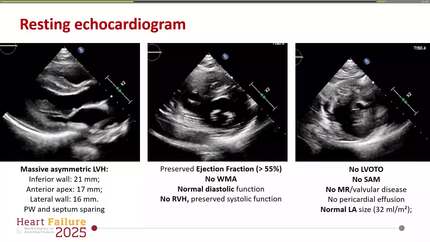 Presentation thumbnail
