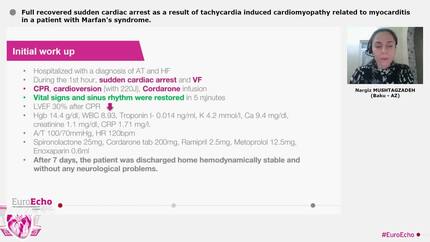 Full recovered sudden cardiac arrest as a result of tachycardia induced cardiomyopathy related to myocarditis in a patient with Marfan's syndrome.