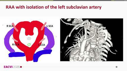 Presentation thumbnail