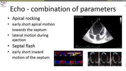 Presentation thumbnail