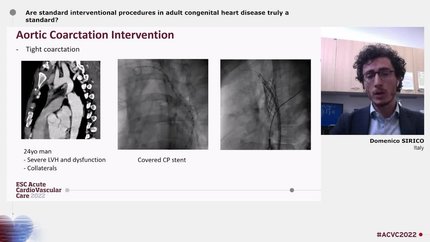 Are standard interventional procedures in adult congenital heart disease truly a standard?