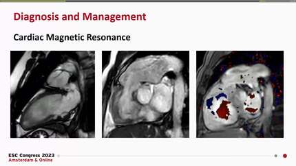 Presentation thumbnail