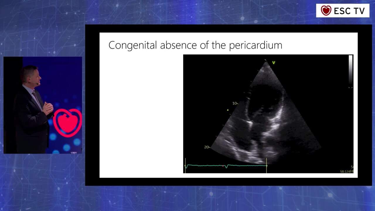 The Great (Interactive) Cardiology Extravaganza