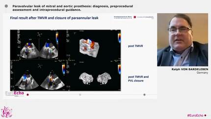 Guidance in ‘nonvalvular’ transcatheter interventions