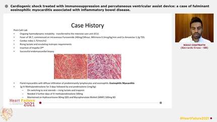 Cardiogenic shock treated with immunosuppression and percutaneous ventricular assist device: a case of fulminant eosinophilic myocarditis associated with inflammatory bowel disease.