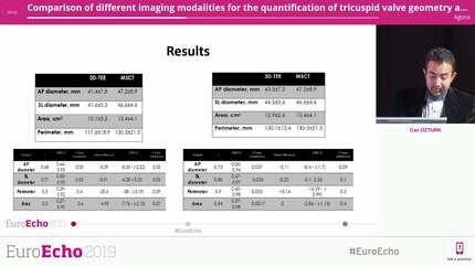 Comparison of different imaging modalities for the quantification of tricuspid valve geometry and regurgitation