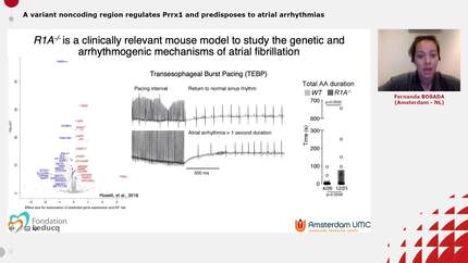 A variant noncoding region regulates Prrx1 and predisposes to atrial arrhythmias