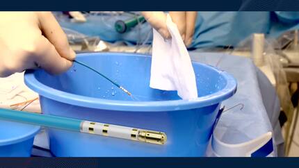 How detailed insights of local atrial arrhythmogenic substrate guides a personalized ablation to improve procedural outcome.