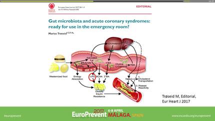 The gut and the heart.