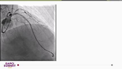 Presentation thumbnail