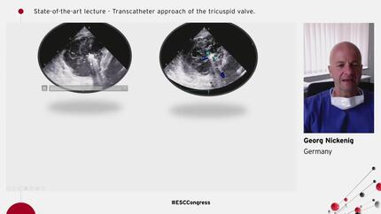Presentation thumbnail