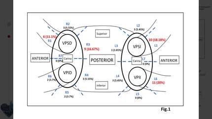 Presentation thumbnail