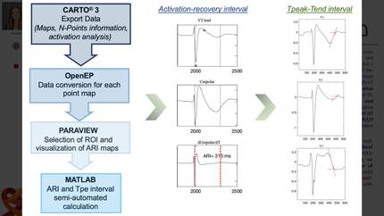 Assessment of repolarization dispersion by using endocardial unipolar electrograms in patients with brugada syndrome and spontaneous coved-type electrocardiographic pattern